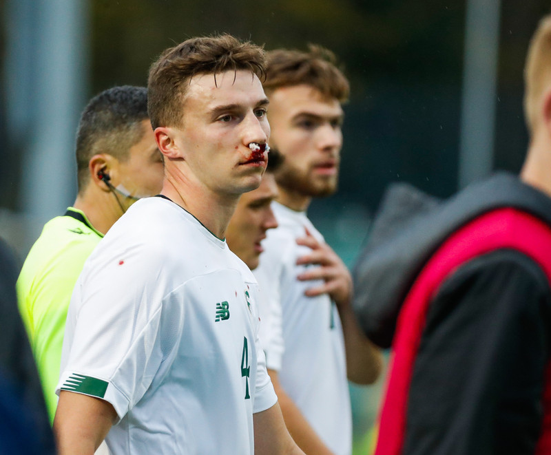 Myndaveisla: U21 vann Íra