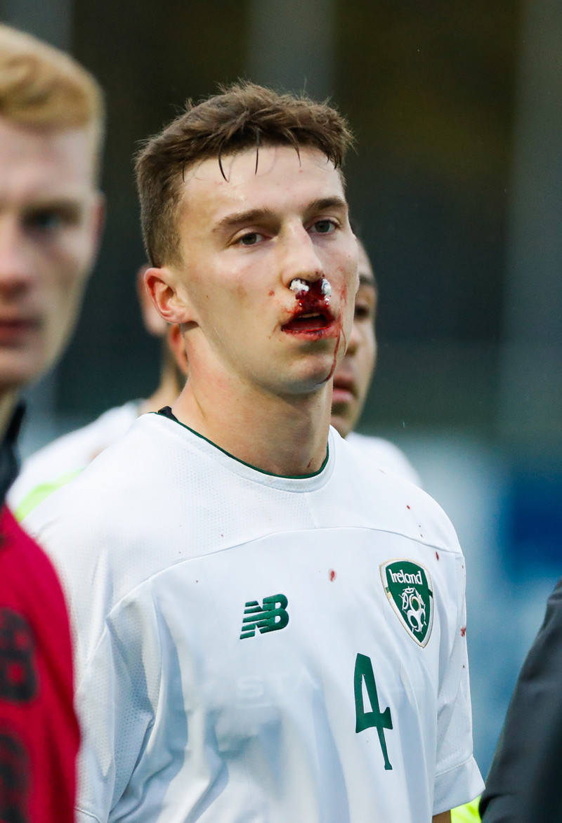 Myndaveisla: U21 vann Íra