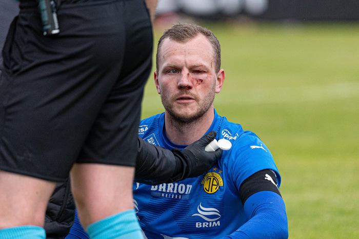 Árni Snær eftir meiðslin í kvöld.