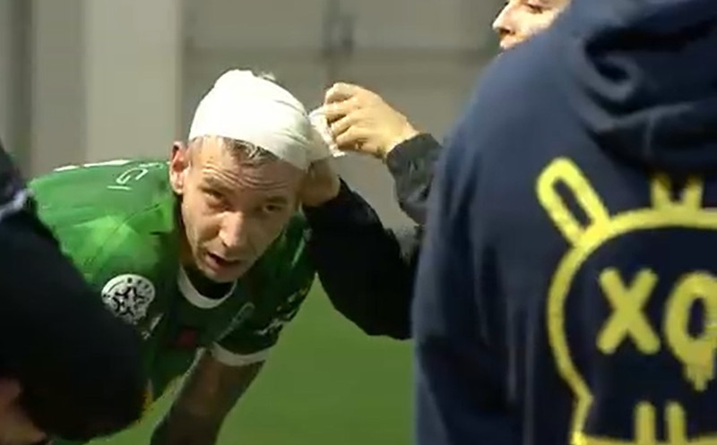 Damir lék með sárabindi á höfðinu.