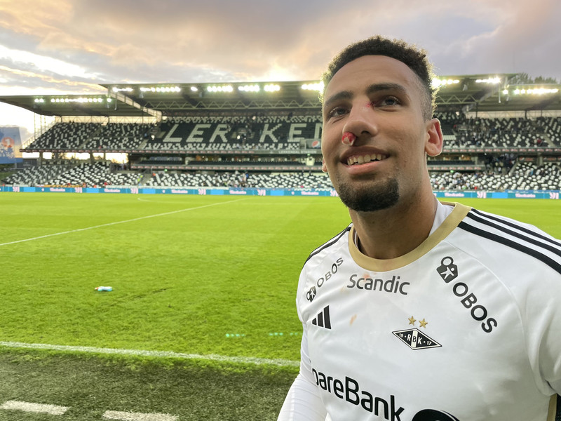 Nefbrotnaði þegar hann skoraði gegn Crusaders í Evrópuleik.