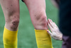 Fótbolti.net - Eyjólfur Garðarsson