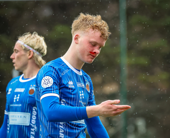 Nefbrotnaði gegn KR.