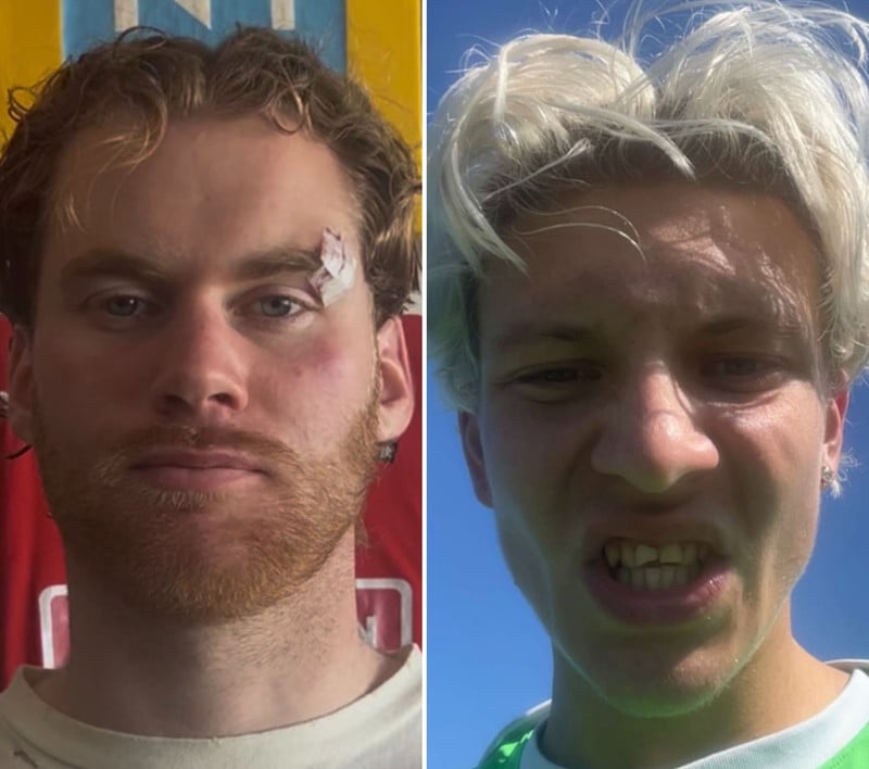 Þorleifur og Jónatan báðir með áverka eftir samstuð á æfingu.
